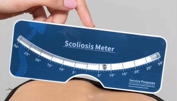 اسکولیومتر Scoliometer