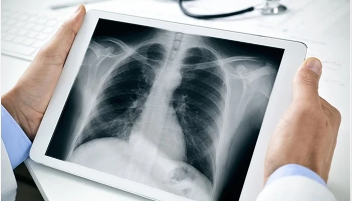 رادیوگرافی Radiography