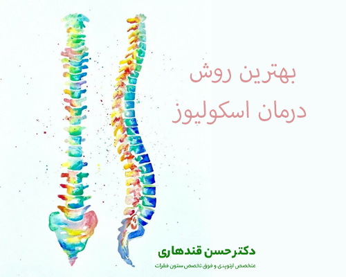 بهترین روش درمان اسکولیوز