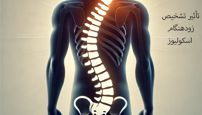 تأثیر تشخیص زودهنگام اسکولیوز