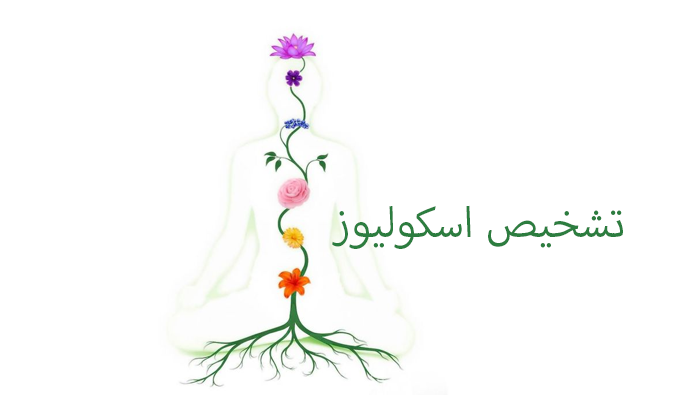 تشخیص اسکولیوز