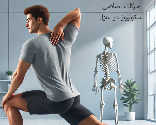  حرکات اصلاحی اسکولیوز در منزل