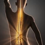 علائم اسکولیوز