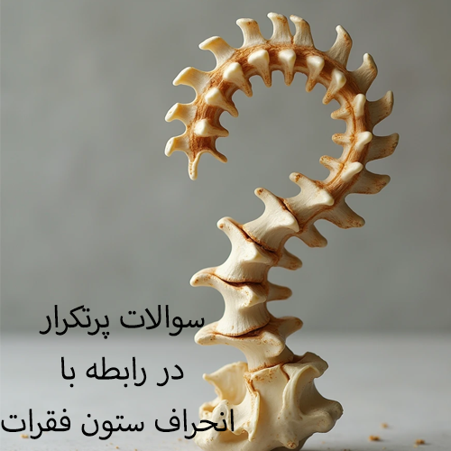 سوالات پرتکرار در رابطه با انحراف ستون فقرات