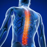 آناتومی اسکولیوز