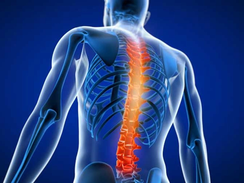 آناتومی اسکولیوز