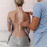 آیا ابتلا به اسکولیوز می تواند ارثی باشد؟