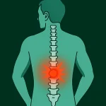 ایا روماتیسم ستون فقرات خطرناک است؟