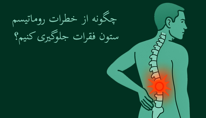 چگونه از خطرات روماتیسم ستون فقرات جلوگیری کنیم؟