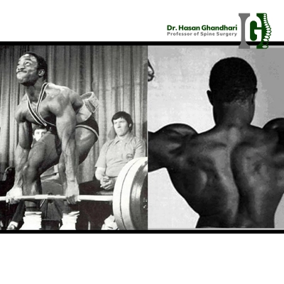 Lamar Gant اسکولیوز