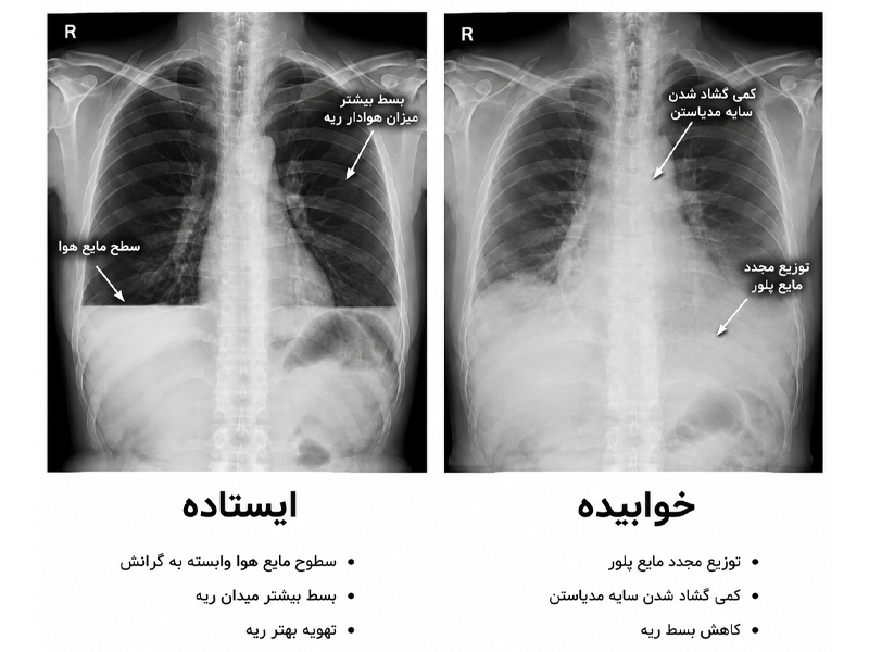X-ray ایستاده با خوابیده